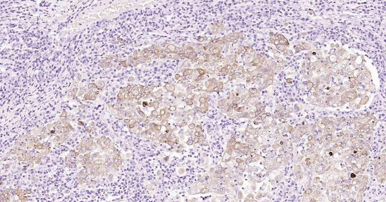 人细胞角蛋白18即用型免疫组化试剂盒-IHC0249H